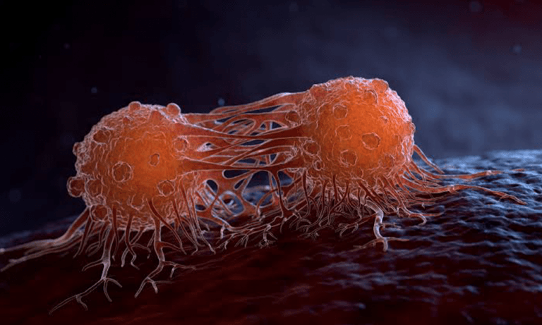 Cancer : Yaoundé met en lumière les progrès de la chimiothérapie